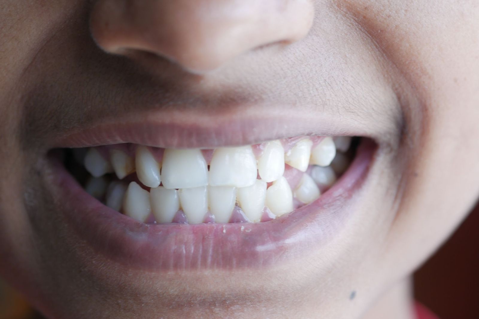 What Is Kundalini Awakening and Teeth Symptoms